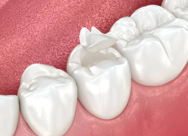 Best Dental Studio in Mount Holly Springs, PA